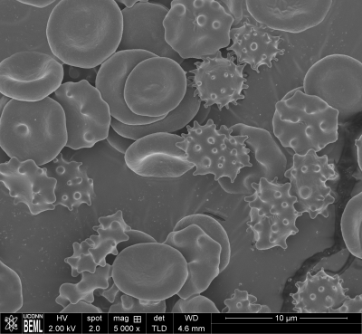 SEM Image of Red Blood Cells